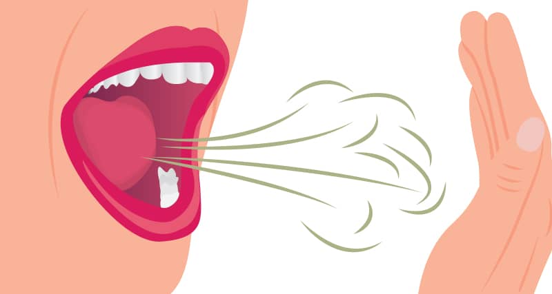 علت و درمان بوی بد دهان