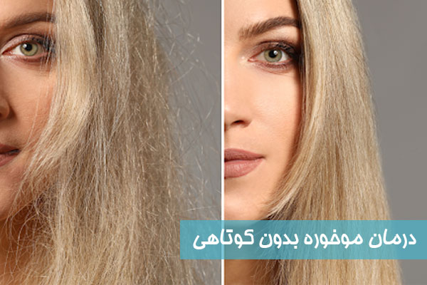 درمان خانگی بدون کوتاهی
