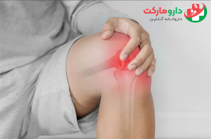 بهترین ویتامین برای زانو درد