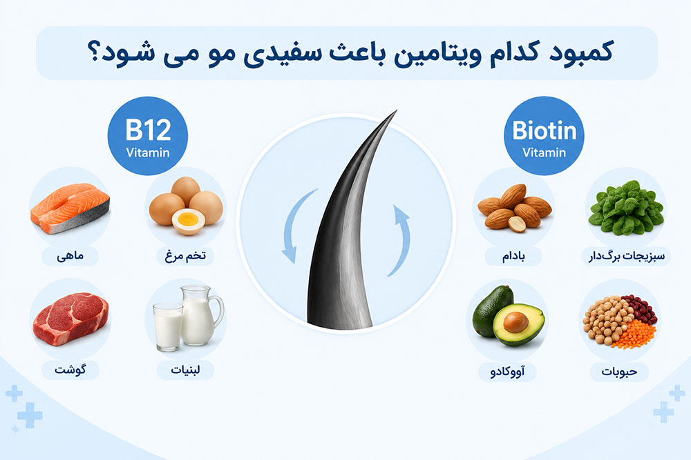 کمبود کدام ویتامین باعث سفیدی مو می شود